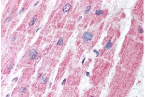 Human Heart (formalin-fixed, paraffin-embedded) stained with MDH1 antibody ABIN291679 at 5 ug/ml followed by biotinylated secondary antibody, alkaline phosphatase-streptavidin and chromogen. (MDH1 Antikörper)