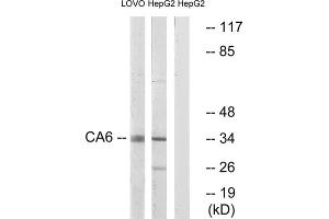Western blot analysis of extracts from LOVO cells and HepG2 cells, using CA6 antibody. (CA6 Antikörper  (C-Term))