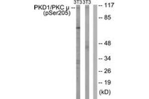 Western blot analysis of extracts from NIH-3T3 cells treated with Anisomycin 25ug/ml 30', using PKD1/PKC mu (Phospho-Ser205) Antibody. (PKC mu Antikörper  (pSer205))