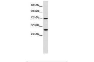 Image no. 1 for anti-Proteasome (Prosome, Macropain) 26S Subunit, Non-ATPase, 4 (Psmd4) (AA 92-141) antibody (ABIN202377) (PSMD4/ASF Antikörper  (AA 92-141))