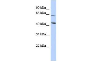 WB Suggested Anti-C5orf33 Antibody Titration: 0. (NADK2 Antikörper  (Middle Region))