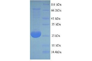 SDS-PAGE (SDS) image for Adiponectin (ADIPOQ) (AA 18-240), (full length) protein (His tag) (ABIN7479385)