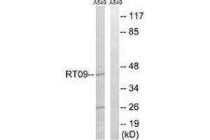 Western blot analysis of extracts from A549 cells, using MRPS9 Antibody. (MRPS9 Antikörper  (AA 91-140))