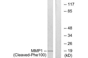 Western blot analysis of extracts from 549 cells, treated with etoposide (25uM, 24hours), using MMP1 (Cleaved-Phe100) antibody. (MMP1 Antikörper  (Cleaved-Phe100))