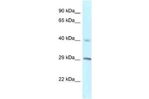 Western Blot showing RCC1 antibody used at a concentration of 1 ug/ml against NCI-H226 Cell Lysate (RCC1 Antikörper  (C-Term))