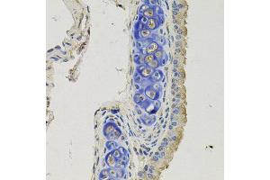 Immunohistochemistry of paraffin-embedded mouse lung using GPHN antibody at dilution of 1:100 (x40 lens). (Gephyrin Antikörper)