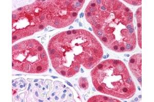 FAH antibody was used for immunohistochemistry at a concentration of 4-8 ug/ml. (FAH Antikörper)