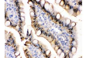 Immunohistochemistry (IHC) image for anti-Fatty Acid Binding Protein 1, Liver (FABP1) (AA 6-36), (N-Term) antibody (ABIN3042384)
