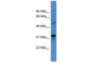 TMEM176B Antikörper  (C-Term)