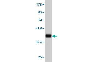 Western Blotting (WB) image for anti-Ral Guanine Nucleotide Dissociation Stimulator-Like 2 (RGL2) (AA 644-743) antibody (ABIN562553)