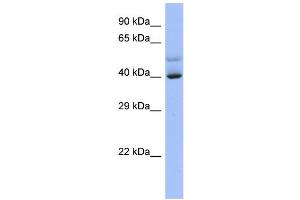 Host:  Rabbit  Target Name:  SCML4  Sample Type:  NCI-H226 Whole cell lysates  Antibody Dilution:  1.