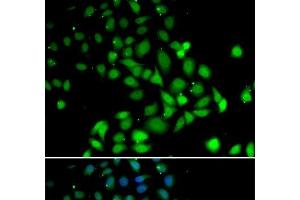 Immunofluorescence analysis of U2OS cells using PARN Polyclonal Antibody (PARN Antikörper)