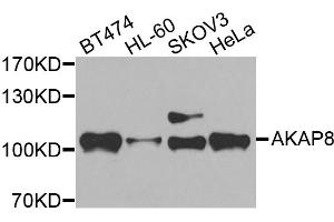 Western blot analysis of extracts of various cell lines, using AKAP8 antibody. (AKAP8 Antikörper)