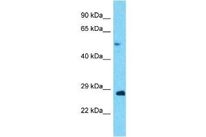 Host:  Rabbit  Target Name:  ANAPC5  Sample Type:  Ovary Tumor lysates  Antibody Dilution:  1. (ANAPC5 Antikörper  (Middle Region))