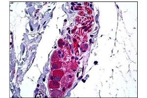 Human Intestine, Ganglion Cells: Formalin-Fixed, Paraffin-Embedded (FFPE) (HDAC6 Antikörper  (N-Term))