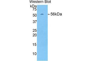 Western Blotting (WB) image for anti-Protein L-Myc (MYCL) (AA 186-439) antibody (ABIN1859918) (LMYC Antikörper  (AA 186-439))