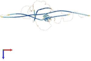 CCDC88B Protein (AA 1-1481) (His tag)