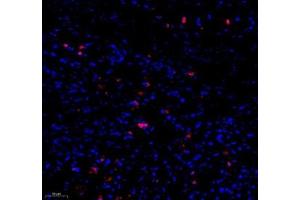 Immunofluorescence (Paraffin-embedded Sections) (IF (p)) image for anti-Caspase 3 (CASP3) (cleaved) antibody (ABIN7073336)