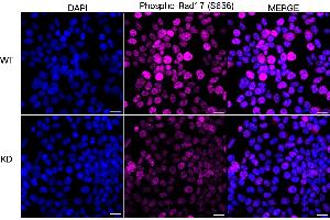 Immunocytochemical staining of HeLa cells using Phospho-Rad17 (S656) antibody (ABIN7800113), 1:1,000), Top panel: wild-type (WT), Bottom panal: Phospho-Rad17 (S656) shRNA knockdown (KD).
