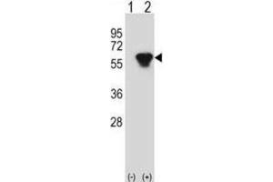 Western Blotting (WB) image for anti-Protein Kinase, CAMP-Dependent, Regulatory, Type II, beta (PRKAR2B) antibody (ABIN2998379) (PRKAR2B Antikörper)