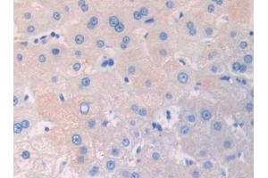 Used in DAB staining on fromalin fixed paraffin- embedded kidney tissue (IL3RA Antikörper  (AA 19-158))