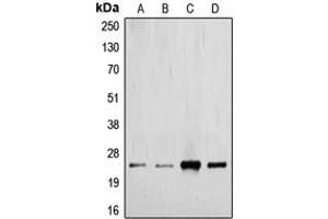 Western blot analysis of TGF beta 2 expression in MCF7 (A), HeLa (B), mouse kidney (C), rat placenta (D) whole cell lysates. (TGFB2 Antikörper  (C-Term))