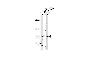 MORC3 Antibody (Center) (ABIN1881548 and ABIN2843364) western blot analysis in HL-60 and U87-MG cell line lysates (35 μg/lane).