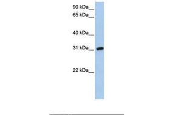 Dickkopf-Like 1 (DKKL1) (C-Term) Antikörper