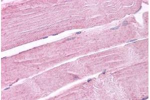 Anti-PTPRA antibody IHC staining of human skeletal muscle. (PTPRA Antikörper  (Cytoplasmic Domain))