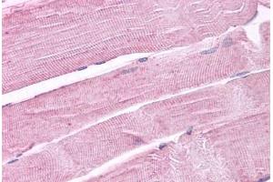 Anti-PTPRA antibody IHC staining of human skeletal muscle.