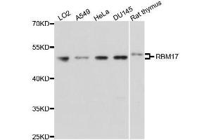 Western blot analysis of extracts of various cell lines, using RBM17 antibody. (RBM17 Antikörper  (AA 1-240))