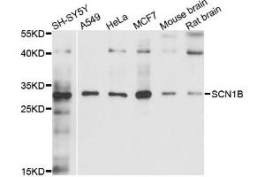Western blot analysis of extracts of various cells, using SCN1B antibody.