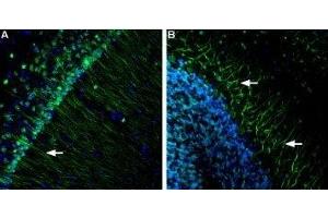 Expression of Presenilin-1 in mouse brain - Immunohistochemical staining of mouse hippocampus and mouse cerebellum using Anti-Presenilin-1 Antibody (ABIN7043552, ABIN7044524 and ABIN7044525), (1:600). (Presenilin 1 Antikörper  (AA 345-359))