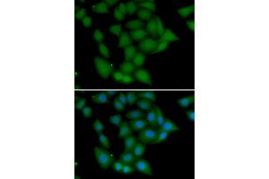 Immunofluorescence analysis of U20S cell using CAMK1 antibody. (CAMK1 Antikörper)