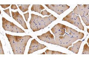 Detection of TNNI2 in Rat Skeletal muscle Tissue using Polyclonal Antibody to Troponin I Type 2, Fast Skeletal (TNNI2) (TNNI2 Antikörper  (AA 1-182))