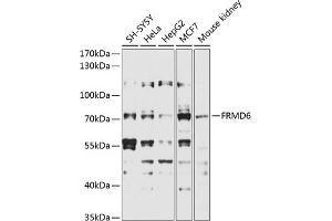 Western blot analysis of extracts of various cell lines, using FRMD6 antibody (ABIN6132194, ABIN6140773, ABIN6140774 and ABIN6225347) at 1:1000 dilution. (FRMD6 Antikörper  (AA 405-614))