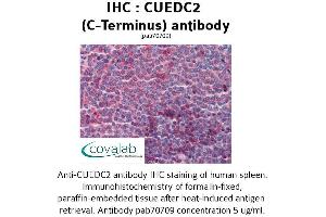 Image no. 2 for anti-CUE Domain Containing 2 (CUEDC2) (C-Term) antibody (ABIN1733372) (CUEDC2 Antikörper  (C-Term))