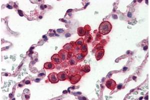Human Lung (formalin-fixed, paraffin-embedded) stained with CLU antibody ABIN364331 at 10 ug/ml followed by biotinylated anti-mouse IgG secondary antibody ABIN481714, alkaline phosphatase-streptavidin and chromogen. (Clusterin Antikörper  (AA 1-333))
