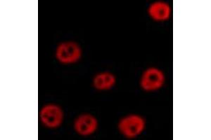 ABIN6267631 staining HT29 by IF/ICC. (PRKAA1 Antikörper  (pSer486))