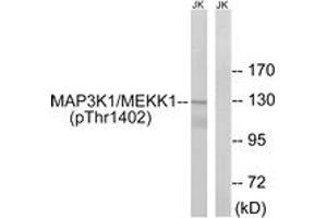 Western blot analysis of extracts from Jurkat cells, using MAP3K1 (Phospho-Thr1402) Antibody. (MAP3K1 Antikörper  (pThr1402))