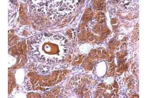 IHC-P Image NLK antibody [N3C3] detects NLK protein at cytosol and nucleus on mouse ovary by immunohistochemical analysis. (Nemo-Like Kinase Antikörper)