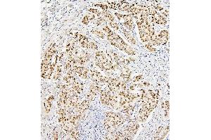 IHC analysis of H1F0 using anti-H1F0 antibody (ABIN7600521). (Histone H1 Antikörper  (AA 20-159))