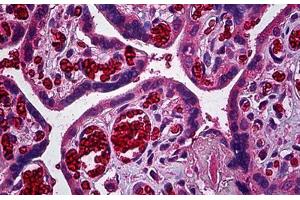 Human Placenta, Trophoblast: Formalin-Fixed, Paraffin-Embedded (FFPE) (ERBB3 Antikörper  (AA 21-332))