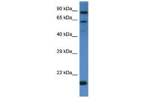 Western Blotting (WB) image for anti-Interleukin 4 Receptor (IL4R) (C-Term) antibody (ABIN2490400) (IL4 Receptor Antikörper  (C-Term))