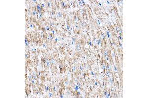 Immunohistochemistry of paraffin-embedded Mouse heart using L Rabbit pAb (ABIN7268192) at dilution of 1:100 (40x lens).