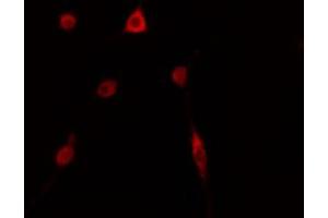 ABIN6274143 staining HepG2 cells by IF/ICC. (TOP3B Antikörper  (C-Term))