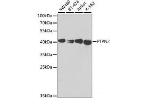 Western blot analysis of extracts of various cell lines using PTPN2 Polyclonal Antibody at dilution of 1:1000. (PTPN2 Antikörper)