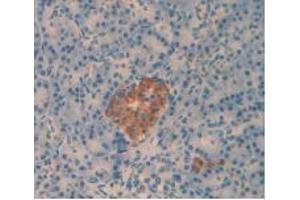 IHC-P analysis of Human Pancreas Tissue, with DAB staining. (Amylin/DAP Antikörper)