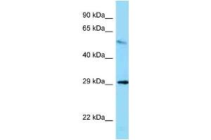 WB Suggested Anti-Memo1 Antibody   Titration: 1. (MEMO1 Antikörper  (Middle Region))