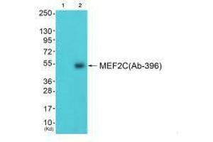 Western blot analysis of extracts from 3T3 cells (Lane 2), using MEF2C (Ab-396) antiobdy. (MEF2C Antikörper  (Ser396))